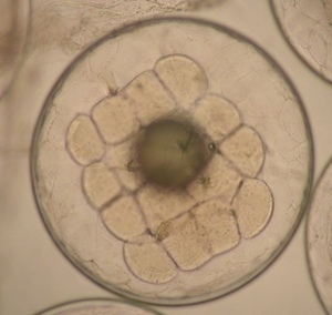 写真：スギの卵 16細胞期