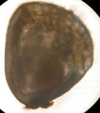写真:ヒメジャコの稚貝の様子4