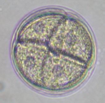 写真：シラヒゲウニ受精卵