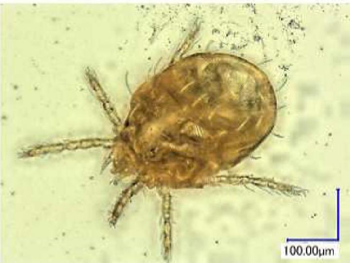 ツツガムシに刺された時の症状