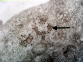 写真：ブルータングウイルスの電子顕微鏡像